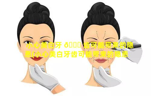 小心美白牙 🍁 齿可能带来的隐患(小心美白牙齿可能带来的隐患有哪些)